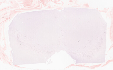 ['deident_4ff3a76b-ca5f-449c-b455-7018028fae25_69b05123.jpg']