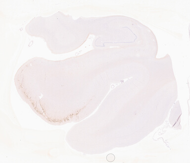 ['deident_47baa7af-57ef-4179-8dbe-579d4f99217e_69b05119.jpg']