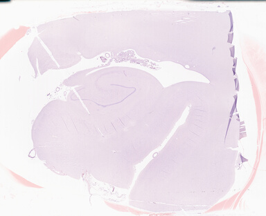 ['deident_9516bb3a-f794-4e3c-93ee-59c89e0f8d5d_69b0514f.jpg']