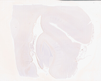 ['deident_1fd10c78-1163-427b-96c0-809dc0630b76_69b05108.jpg']