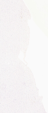 ['deident_bfea0244-90d6-49c4-bfa5-c44d4af41cab_69b05163.jpg']