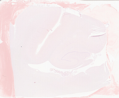 ['deident_e3e1ce75-9e26-49b6-906c-ef5c90123610_69b05173.jpg']