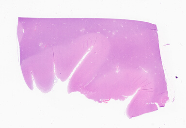 ['deident_5044d1c9-5143-4c73-9f6d-3ddc076c5164_69b05126.jpg']