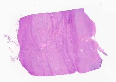 ['deident_2bb4753e-bf33-47e1-8397-52019e0ebecd_69b05117.jpg']