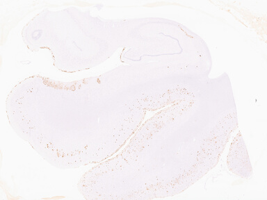 ['deident_895ddcac-74a4-44a7-a60b-367924de6b3d_69b05140.jpg']