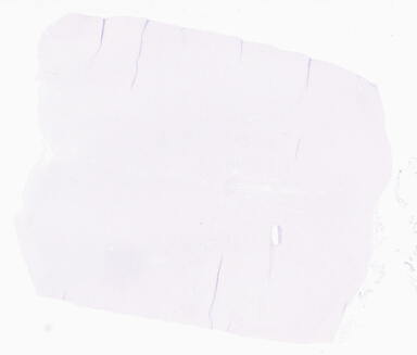 ['deident_962bc85e-a80d-4199-b5eb-b4c3b5627898_69b05151.jpg']