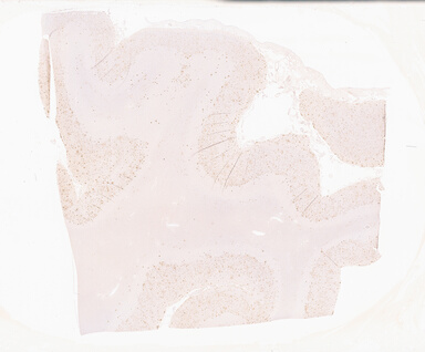 ['deident_7c046a4f-66b8-4aaa-a11a-b89a5fd0e08d_69b0513c.jpg']