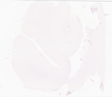 ['deident_48757039-49a6-4754-8d7e-337285a0de45_69b0511e.jpg']
