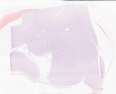 ['deident_243ca593-b62c-4584-a3bc-c365edbd1dca_69b0510a.jpg']