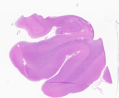 ['deident_5a376773-7cb1-4aea-8043-c4701de5322d_69b0512e.jpg']