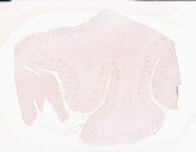 ['deident_ca237a65-8aa2-466f-b9d7-a96701057967_69b0516c.jpg']