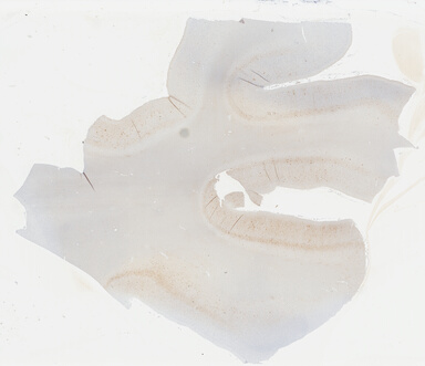 ['deident_1df0600a-0f73-4068-9176-3dcbda755b13_69b03b5f.jpg']