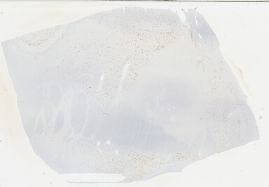 ['deident_40b1e01b-d446-4972-9932-397df6d0ecc5_69b03b71.jpg']