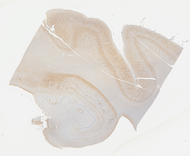 ['deident_9e000033-0435-4daa-9960-f9aee0342f90_69b03ba7.jpg']