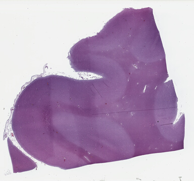 ['deident_53caa77f-7d10-4515-b110-2d88aaf7e953_69b03b84.jpg']
