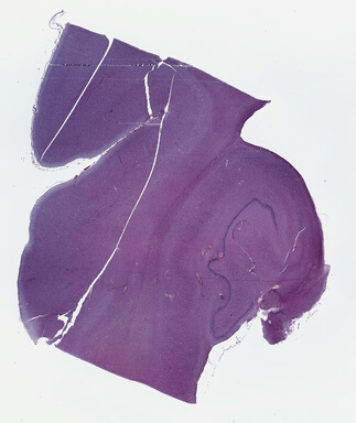 ['deident_e23efc5a-d229-41aa-ae9f-ed04c2bb4528_69b03bbd.jpg']
