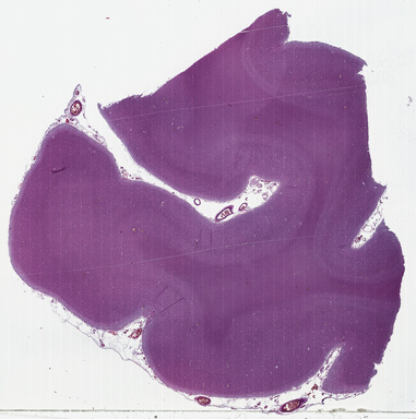 ['deident_834c8077-64fb-4891-b617-e5d72db6b16c_69b03b98.jpg']