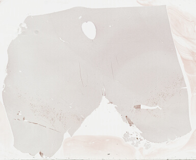 ['deident_6c9c847f-50e5-4f38-8f5b-e539ca30f37a_69b03b8f.jpg']
