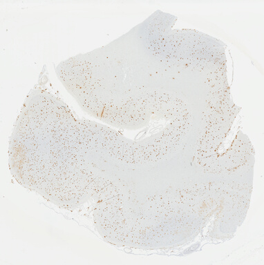 ['deident_9b80188e-c680-4b10-b528-deffbf8380ae_69b03ba5.jpg']
