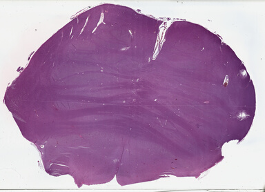 ['deident_59945c14-aa61-4c62-9375-94dda72bd1cc_69b03b85.jpg']