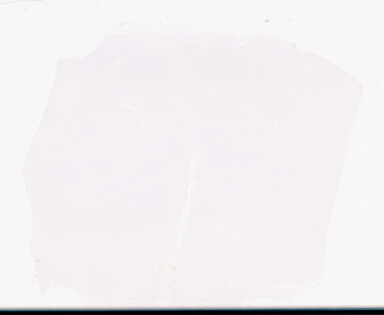 ['deident_a7be137f-5206-4840-bd74-7d81e47eeb0a_69d96112.jpg']