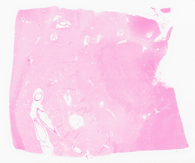 ['deident_ff4b6460-4ad0-47d4-aa71-2208fb28e89d_69d96133.jpg']