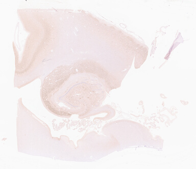 ['deident_f1582c33-3a15-4ce7-a006-dcccdd6fefe6_69d9612b.jpg']