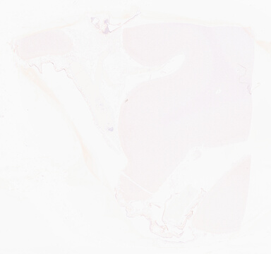 ['deident_a4325976-03f0-425e-adcc-cf7a8c807714_69d9610c.jpg']