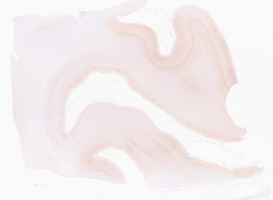 ['deident_10dbf784-464f-44f7-ac2d-5a6265281997_69d960c5.jpg']