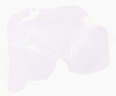 ['deident_5c6fbd3d-595b-477a-becf-422106d83ba3_69d960ee.jpg']