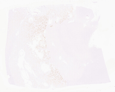 ['deident_f4d3743d-a414-435e-bbdb-8f812a464eb5_69d9612d.jpg']