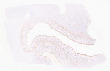 ['deident_b1a448aa-2f86-4ec8-ae30-f8e898598b61_69d96117.jpg']
