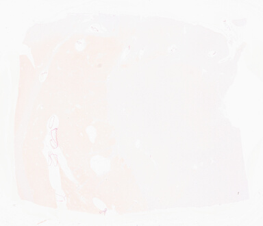 ['deident_7ce85641-5f3c-4c1d-b8ee-6fd818d018da_69d960ff.jpg']