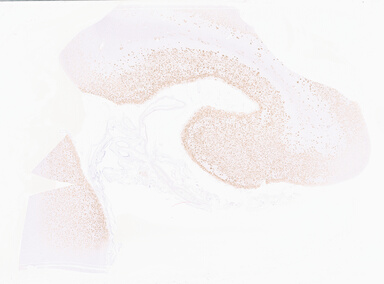 ['deident_b3d7f1b1-d2e6-42f6-8b68-023a9b8a71e0_69d9611a.jpg']