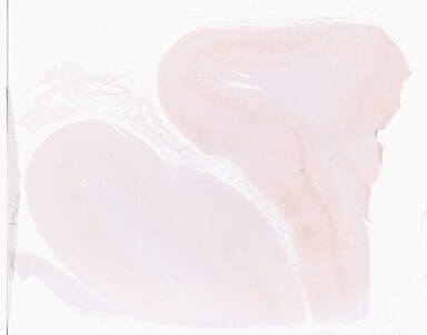 ['deident_a6baf0a2-c3d7-4ff1-b8e0-412b702d3102_69d96110.jpg']