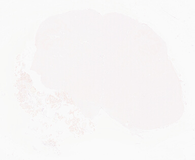['deident_2644bc2d-2534-41f2-b893-1bf7e8b7097c_69d960d3.jpg']