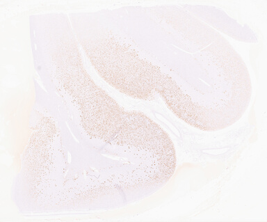 ['deident_b6e59779-2dde-47fd-be41-3bb0a2da9163_69d9611e.jpg']