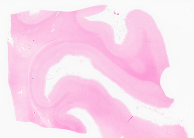 ['deident_b4942f29-74c8-43be-86cc-2fc3a2932330_69d9611c.jpg']