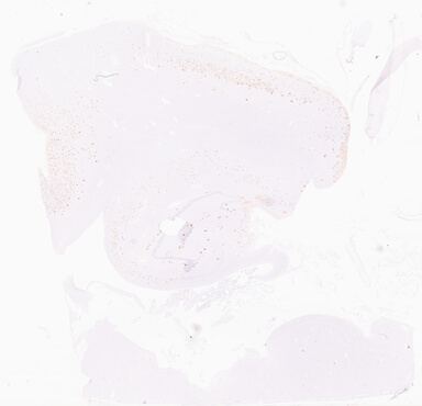 ['deident_879a622f-7ae9-4d09-ba23-657ad300b862_69d96106.jpg']