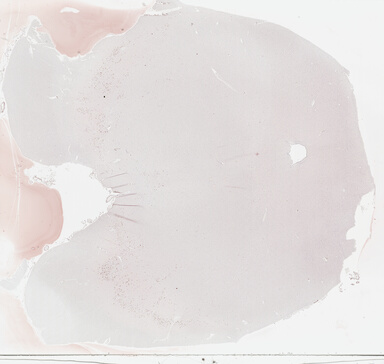 ['deident_4ad7717d-5f9e-45de-85f8-9df20dc62c3f_69b0367c.jpg']