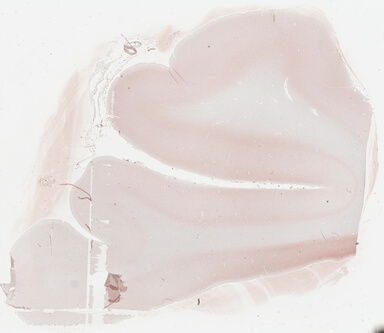 ['deident_b6024040-20a3-47f6-b991-00f5af242306_69b036a7.jpg']