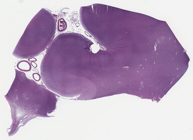 ['deident_4d5c245e-3402-4611-a11c-0bb9893f7eaa_69b0367f.jpg']