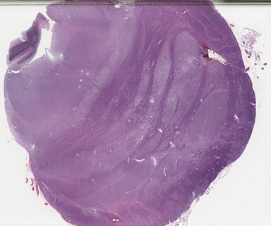 ['deident_32b64342-c4e7-4072-848b-65726f2790a2_69b0366e.jpg']