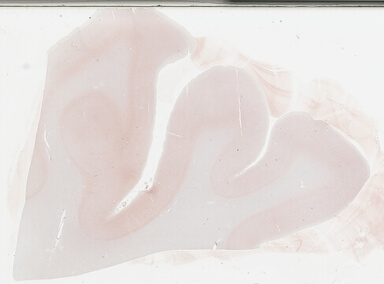 ['deident_67cf78e1-286c-48cb-8939-d51cd67f51bd_69b03689.jpg']