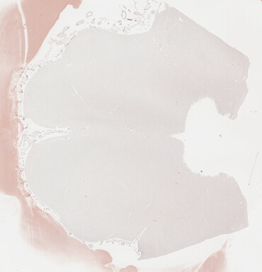 ['deident_0ce0dcf1-5e21-424e-a387-c72b942169e9_69b03661.jpg']