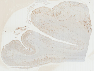 ['deident_388f75c2-000c-48c4-9f73-265796afe1a0_69b03674.jpg']