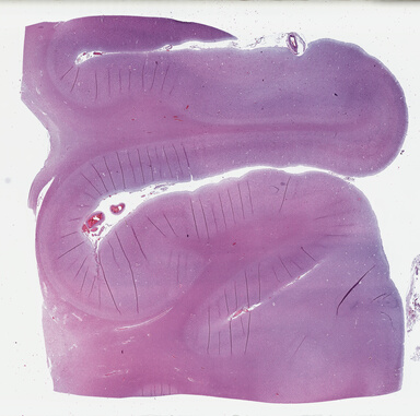 ['deident_db386a03-a1ff-459d-b05d-37ccfde47d0f_69b04673.jpg']