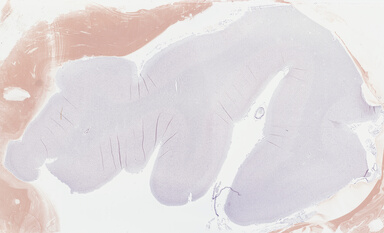 ['deident_fae4312a-104f-4f86-a31f-190896895b00_69b0467e.jpg']