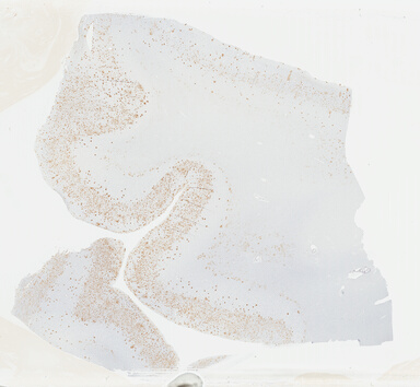 ['deident_016d9846-55d0-4946-8c54-6f17ea908087_69b04636.jpg']