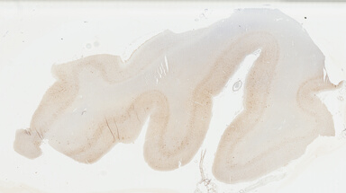 ['deident_34924249-16a1-4cc5-8166-c2d864fdefa1_69b0463f.jpg']